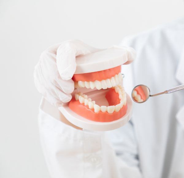 虫歯とそのメカニズム